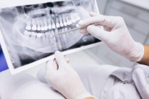 Imagen dentista revisando la radiografía de la boca de un paciente.
